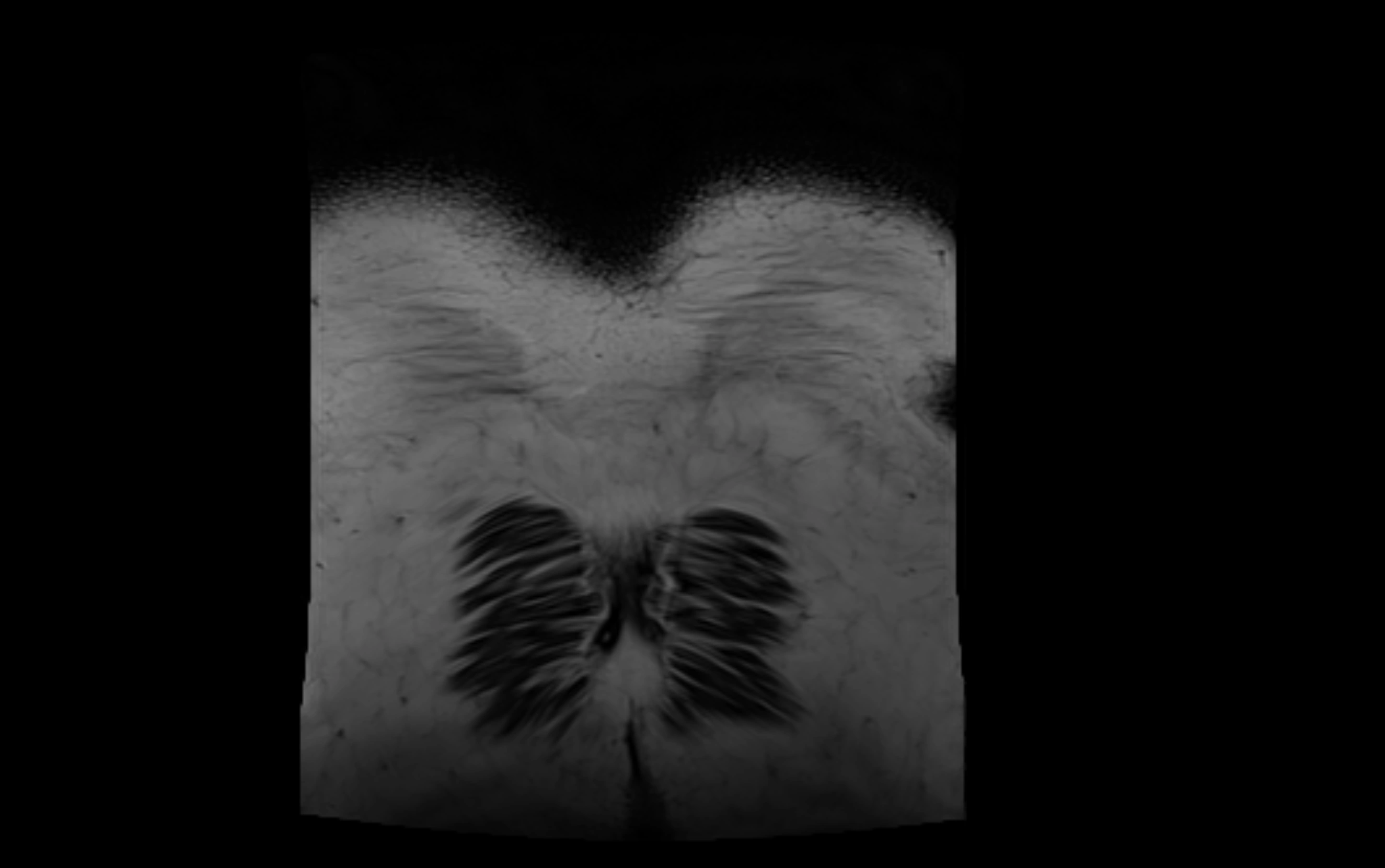MR lumbosacral plexus cross sectional anatomy 3T  radiology  image-img-09001-00091.webp